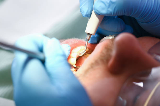 Best Emergency Dental Care for Broken or Chipped Teeth in Barberton, WA