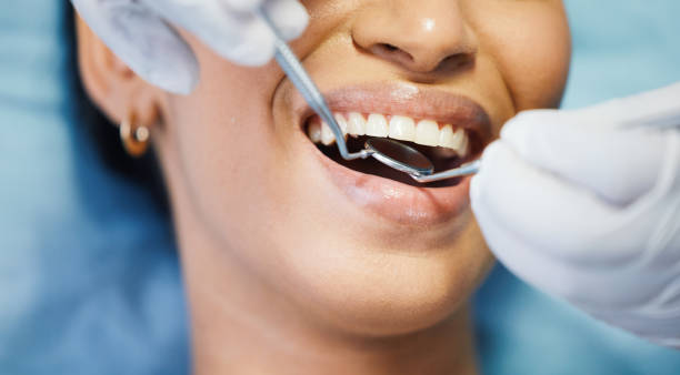 Best Emergency Dental Care for Broken or Chipped Teeth in Barberton, WA